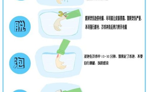 烫伤急救（烫伤急救五步正确的是）
