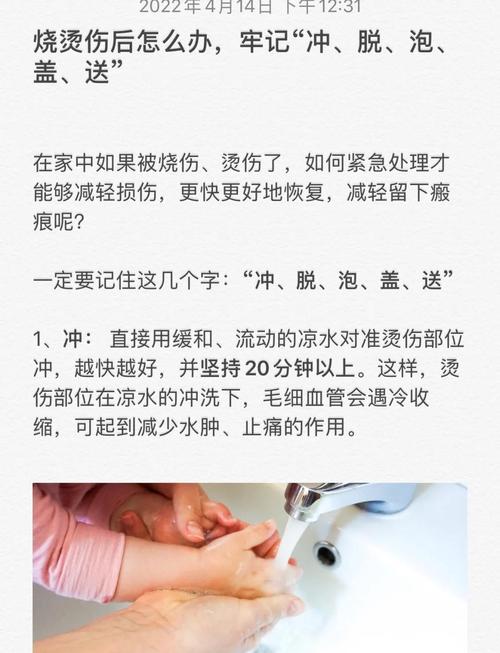 烫伤急救(烫伤急救五步正确的是)