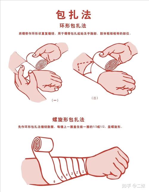 止血包扎技巧（止血包扎技巧视频）